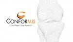 ConforMIS logo with knee diagram