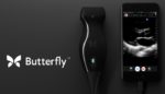 Butterfly iQ