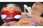 AtaCor Medical