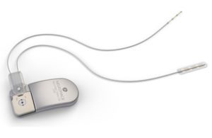 NeuroPace RNS System