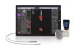 Boston Scientific's Vercise Gevia DBS