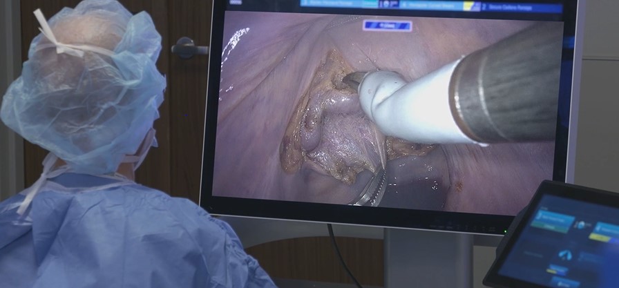 Medtronic robot-assisted surgery system