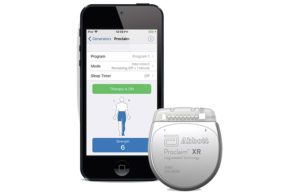 A photo of Abbott's Proclaim XR 5 IPG Model 3660 and the Patient Controller app.