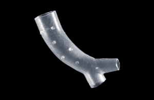 patient-specific-stents