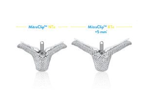 Abbott MitraClip transcatheter mitral valve repair
