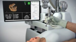 Neocis Yomi robot robot-assisted surgery dental