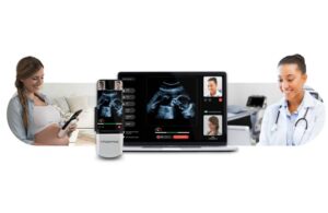 Pulsenmore ES prenatal ultrasound (1)