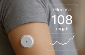 This is an Adobe Stock image of an Abbott Freestyle Libre 2, part of a line of Freestyle Libre CGMs that have enabled Abbott to be a CGM market standout.