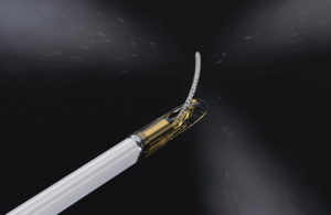 This is a Francis Medical marketing image of the distal end of its Vanquish water vapor ablation system.