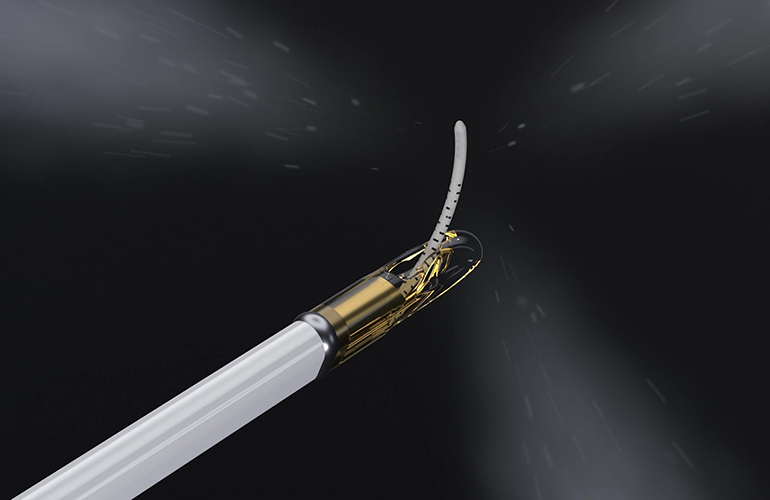 Francis Medical reports first commercial cases with Vanquish system