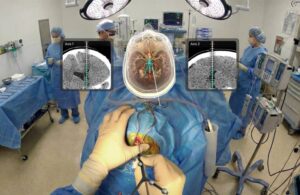 Medivis Cranial Navigation AR Guidance (1)