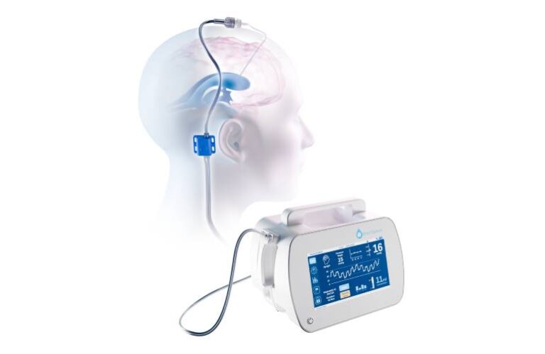 BrainSpace wins FDA clearance for brain fluid management tech