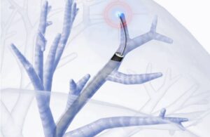 Leadoptik LIA system in situ