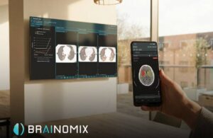 Brainomix 360 Stroke and e-Lung AI platforms (1)