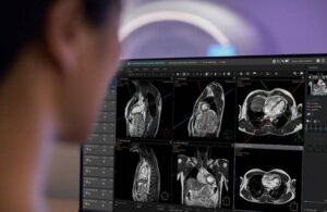 Philips SmartHeart MR Workflow