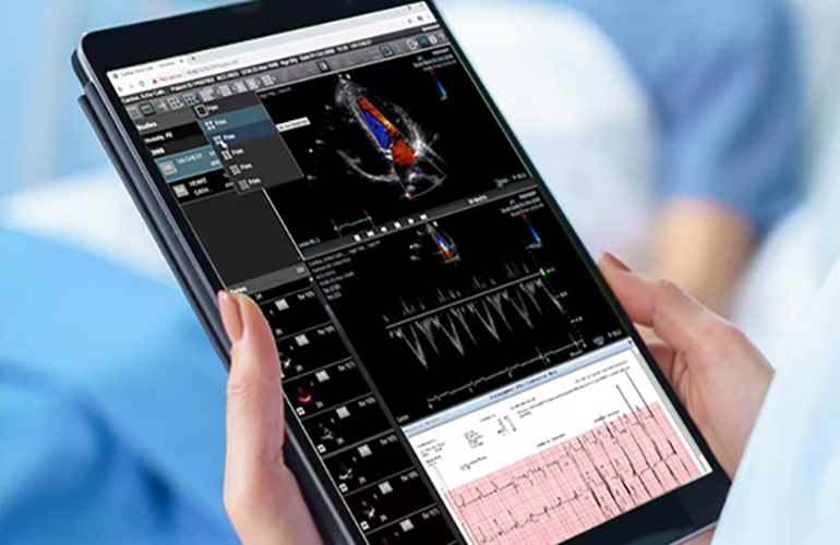 GE HealthCare earns FDA clearance for next-gen diagnostic viewer