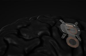 Epia Neuro BCI Device