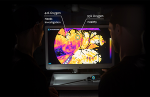 HyperVision surgical vision tech