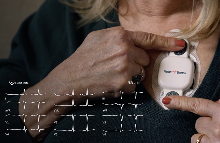 HeartBeam starts pilot study of on-demand 12-lead ECG patch