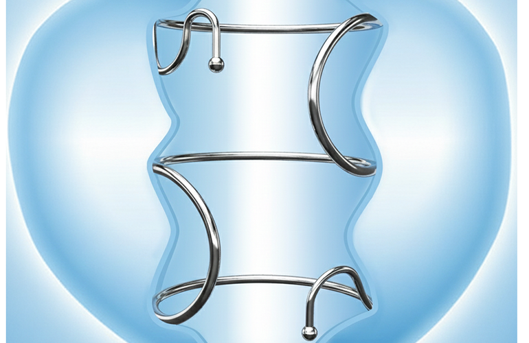 Zenflow findings back BPH treatment device