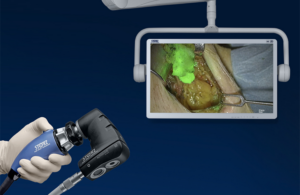 Karl Storz Rubina Lens exoscope open surgery