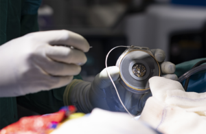 The Paradromics Connexus early feasibility study BCI implant taking place at the University of Michigan