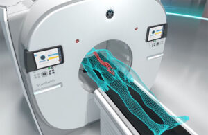 An illustration of GE HealthCare’s StarGuide SPECT/CT technology in use.