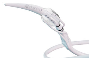 A photo of Revita's endoscopic catheter.