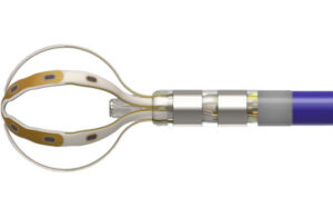 An image of Boston Scientific’s Faraflex pulsed-field ablation (PFA) and mapping catheter.