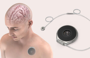 The Paradromics Connexus sytem.