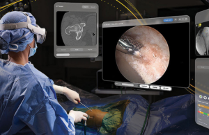 This is a Stryker marketing image of its SportsSuite Vision using the mixed-reality Apple Vision Pro.