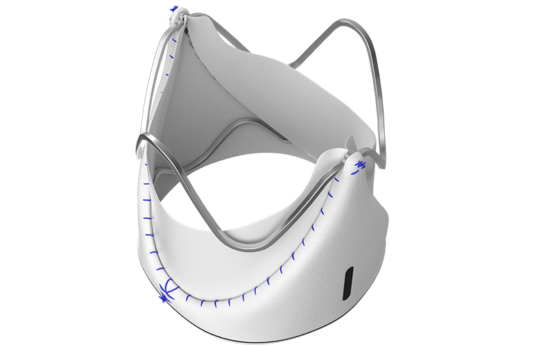 The Austus valve can reach a maximum size of 22 mm, comparable to an adult-sized pulmonary valve.